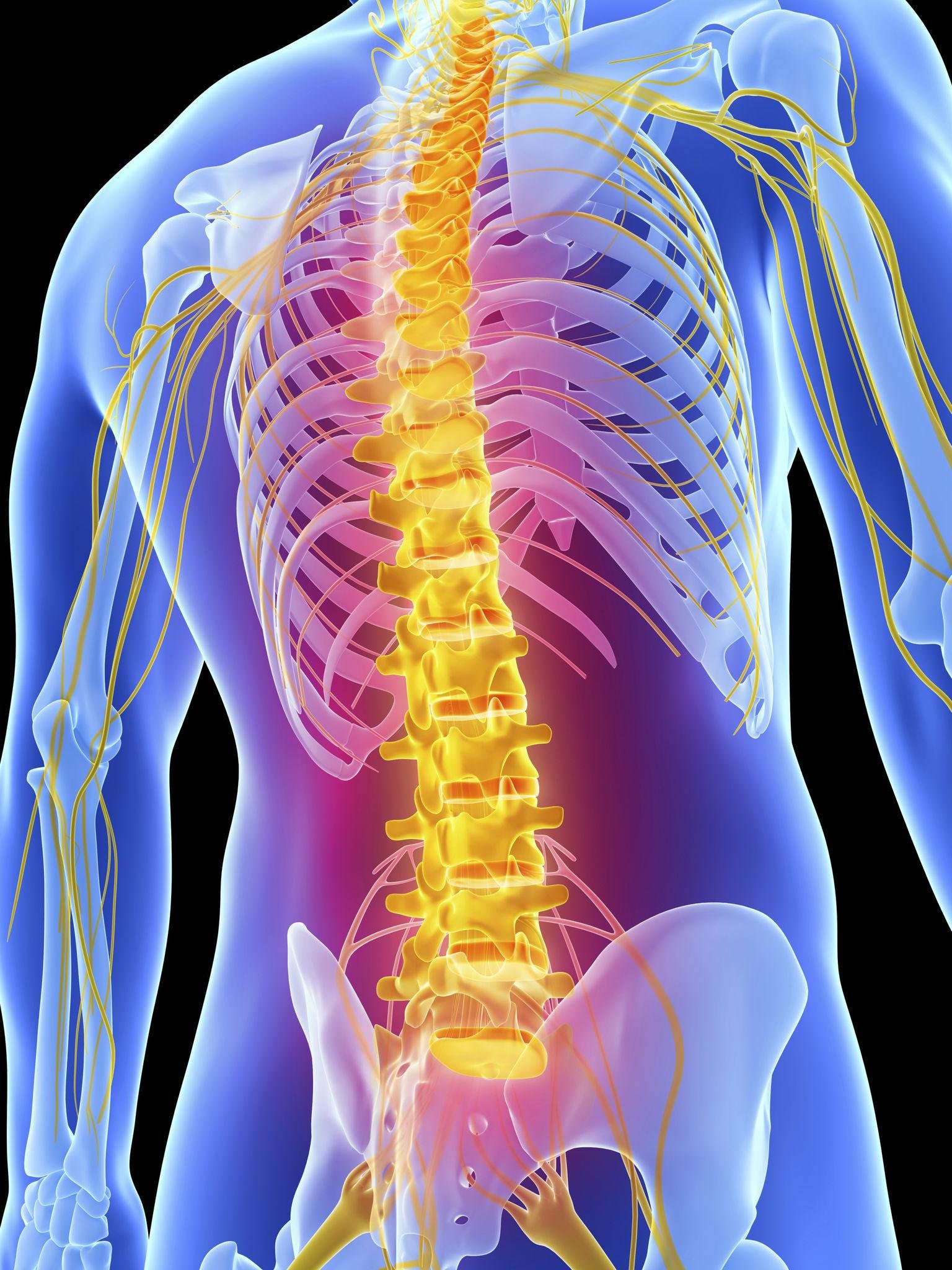 Spondylosis