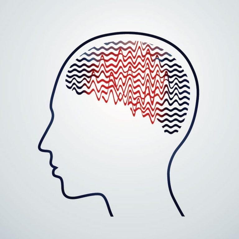Epilepsy