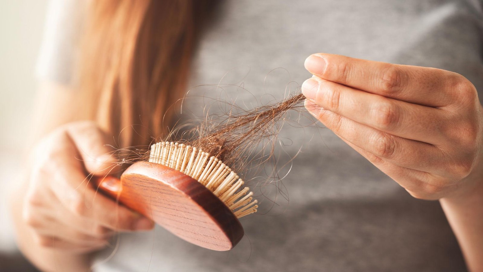 Alopecia