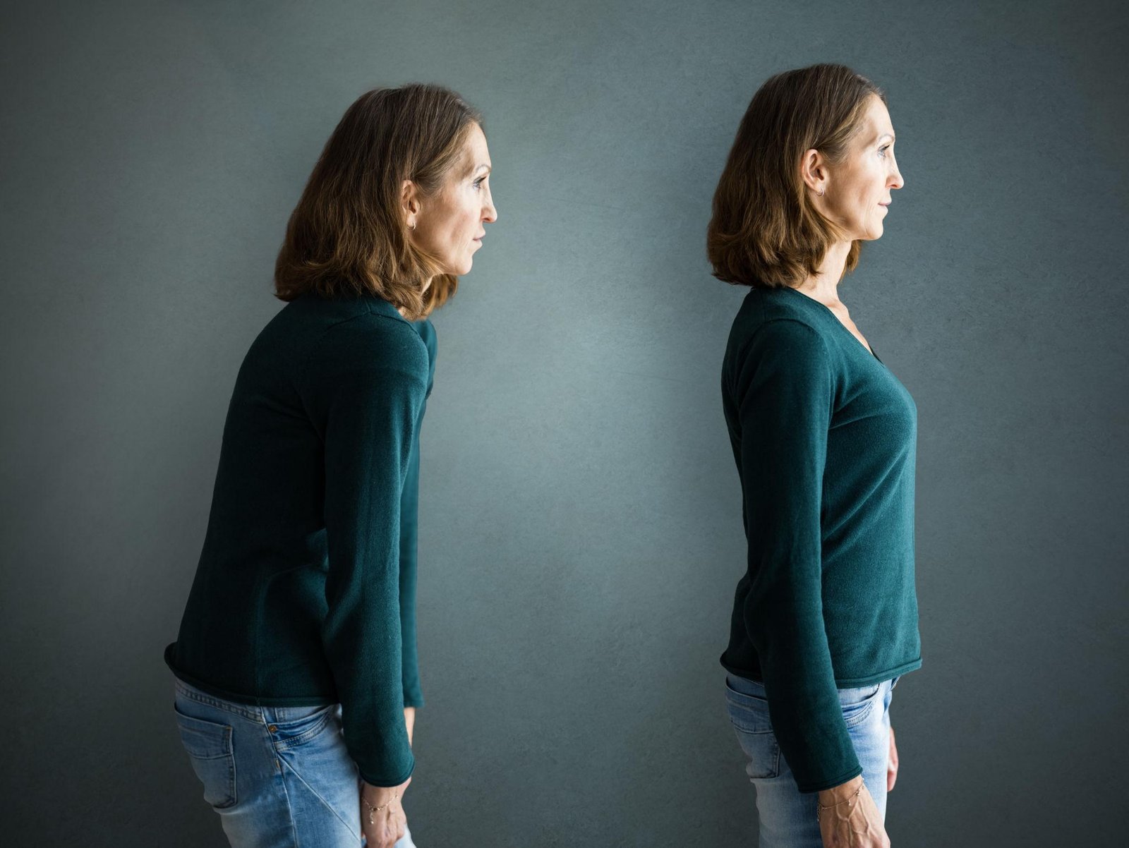 Kyphosis