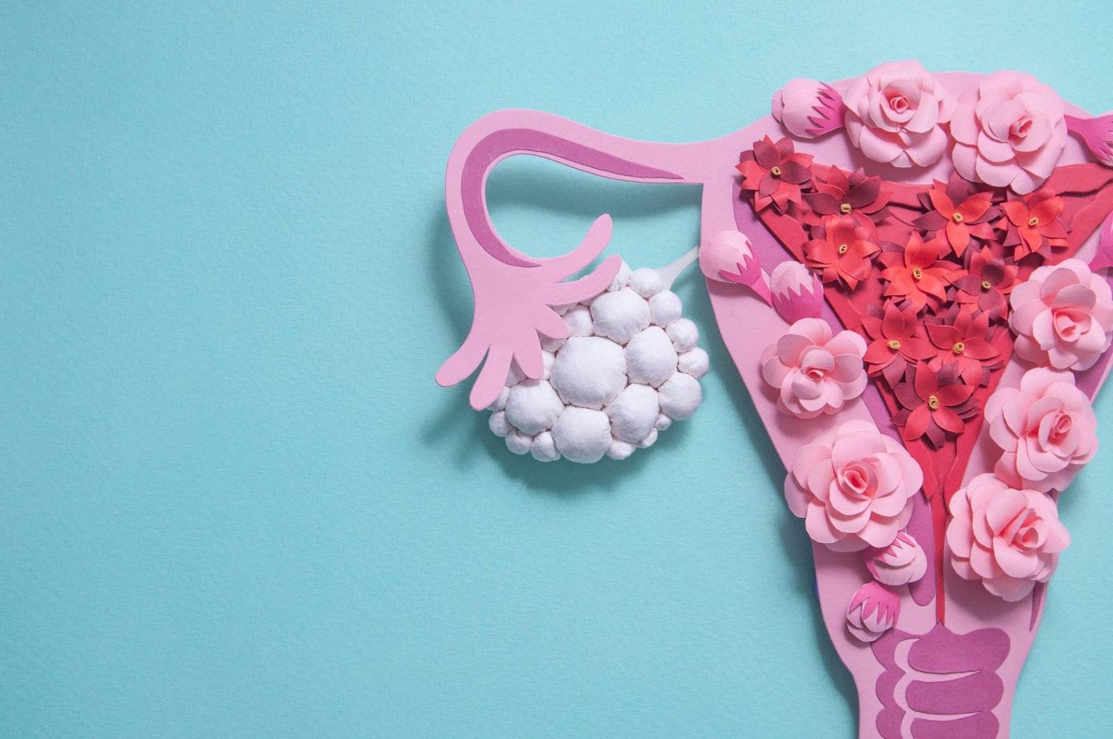 PCOS