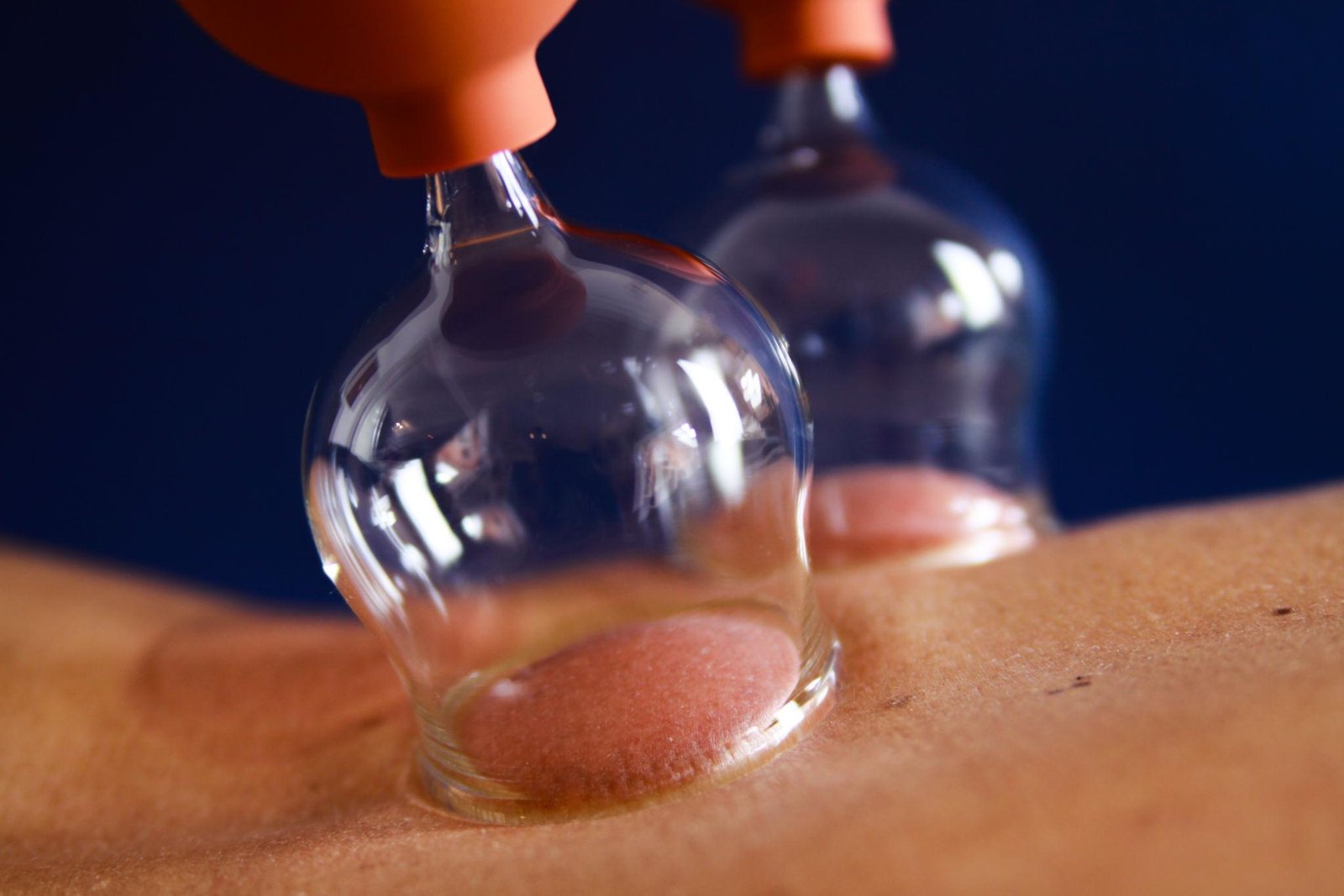Cupping Therapy