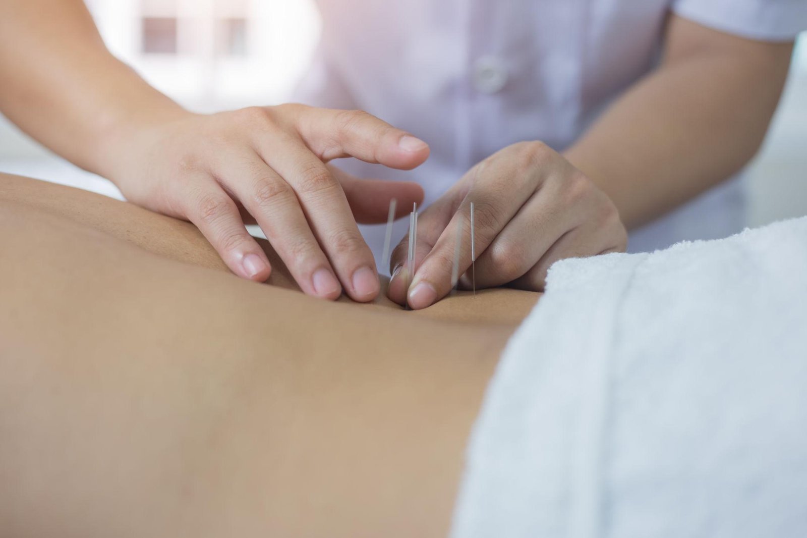 Chinese TCM – Acupuncture