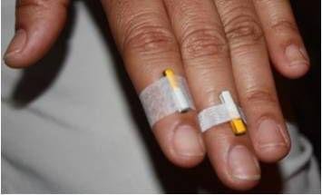 Magnet Therapy