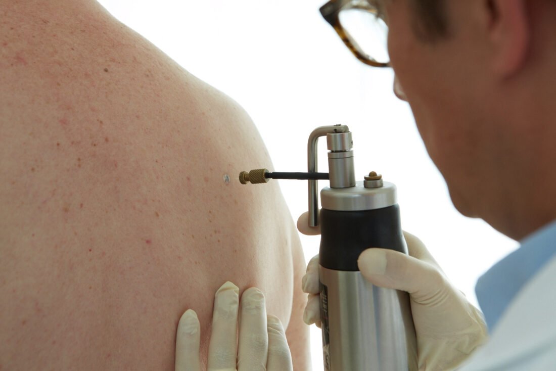 Dermatologic Therapy