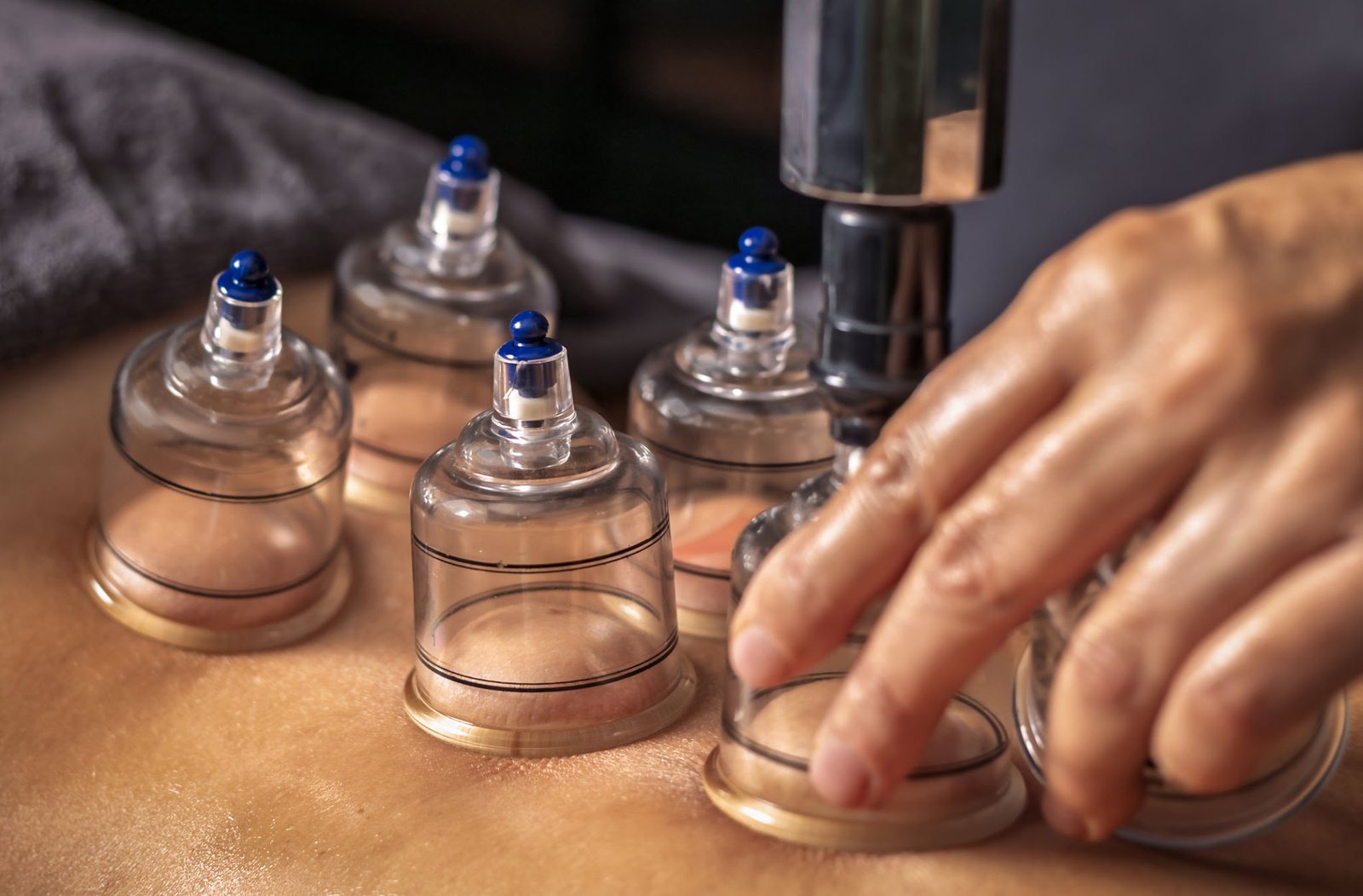 Dry Cupping