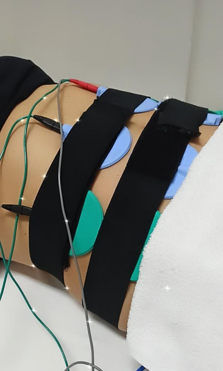 TENS Therapy